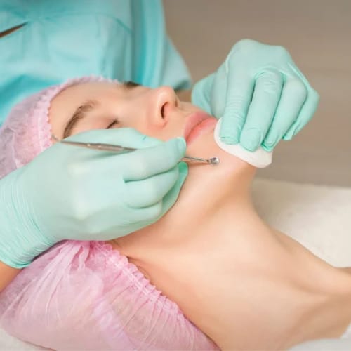 Tratamiento para el Acné