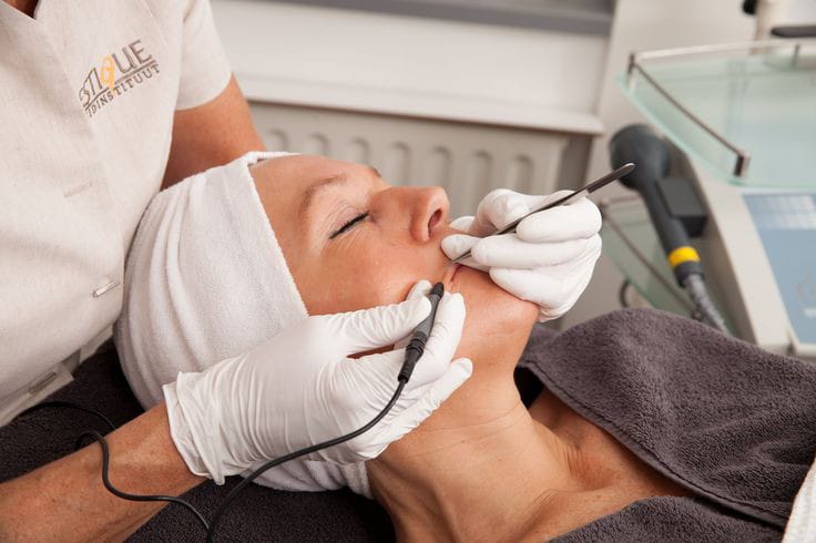Electrólisis definitiva facial