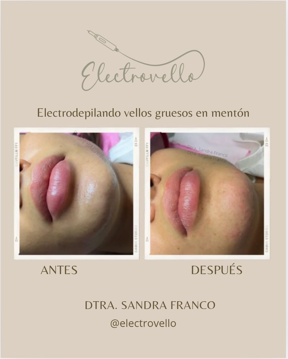 Tu autoestima, tu historia, tu elección