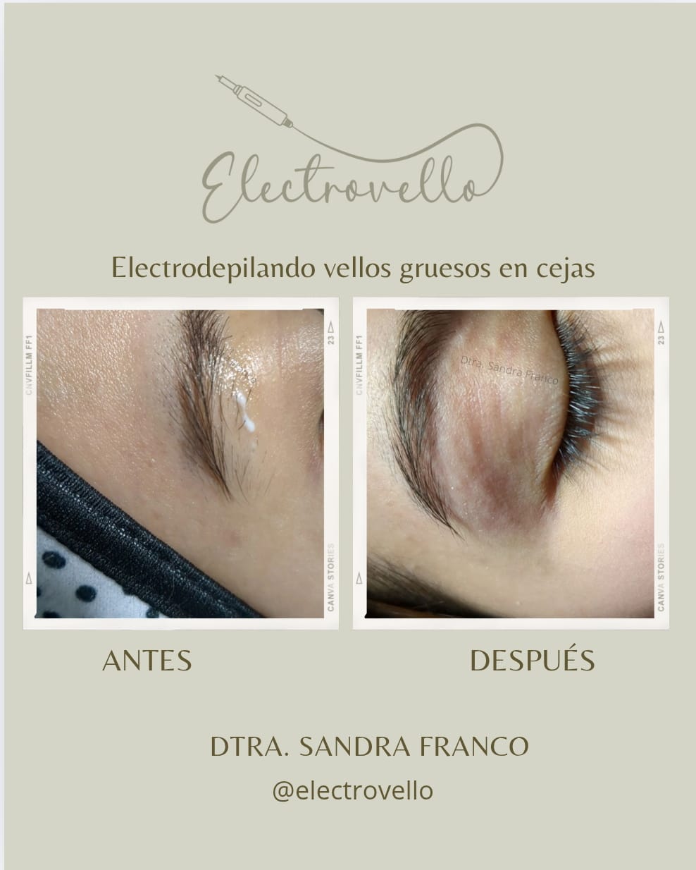 Piel saludable y libre